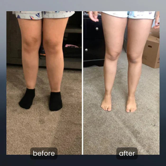 Leg Massager with Heat – Relief for Tired & Sore Legs.